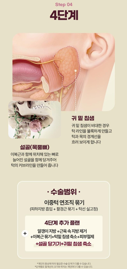 Double Chin Removal Surgery: Essential Information from Effects to Recovery Time image 10