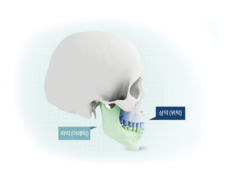 오차가 만드는 큰 차이, 디에이 양악수술 관련 이미지 4