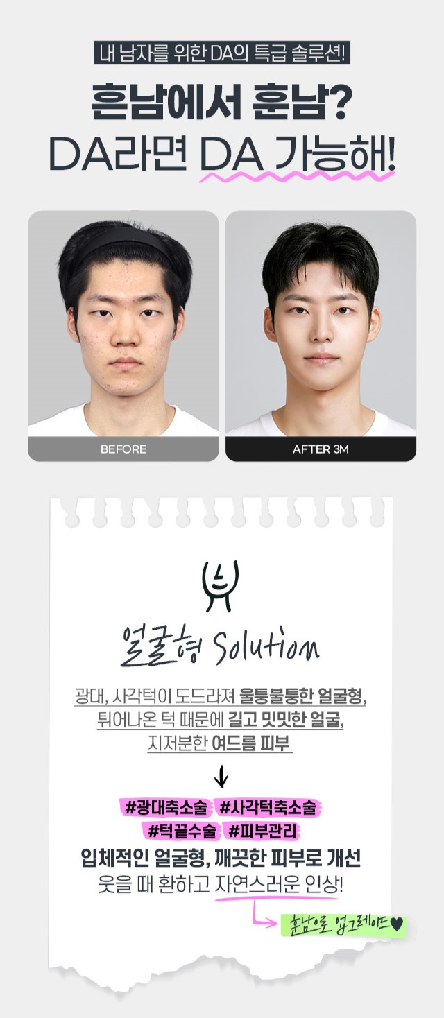 맥미남 | 소심남에서 훈남으로 - 디에이성형외과 방송출연 관련 이미지 4