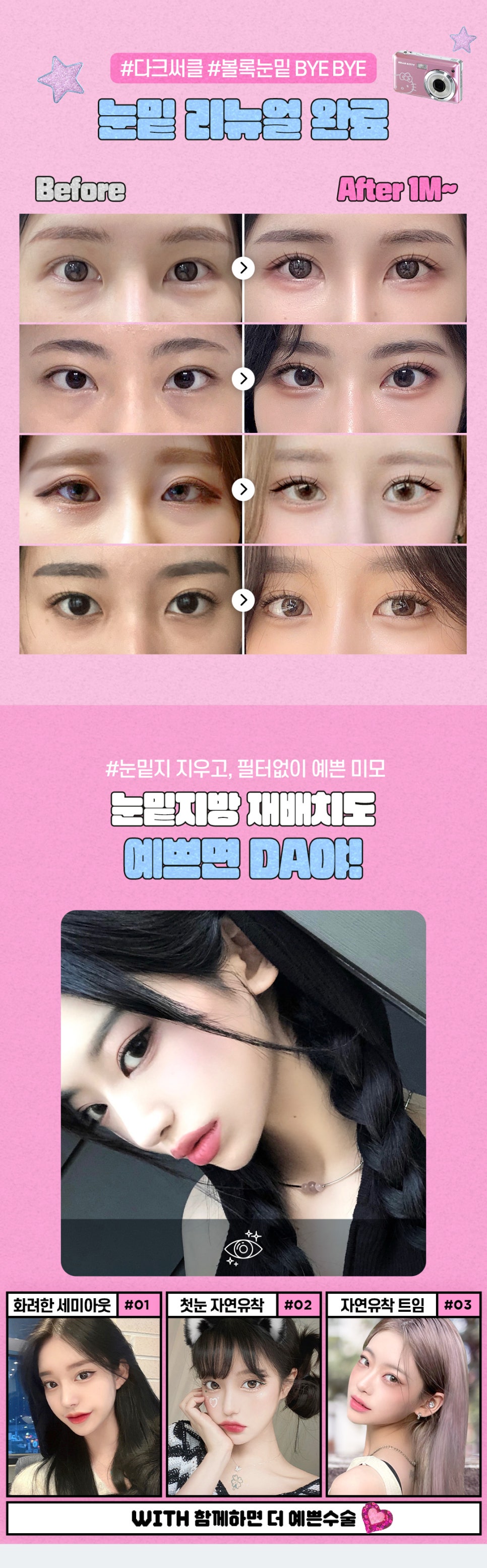 강남역 눈밑지방재배치 잘 하고 합리적인 곳은? 관련 이미지 6
