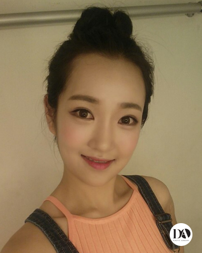오차가 만드는 큰 차이, 디에이 양악수술 관련 이미지 7