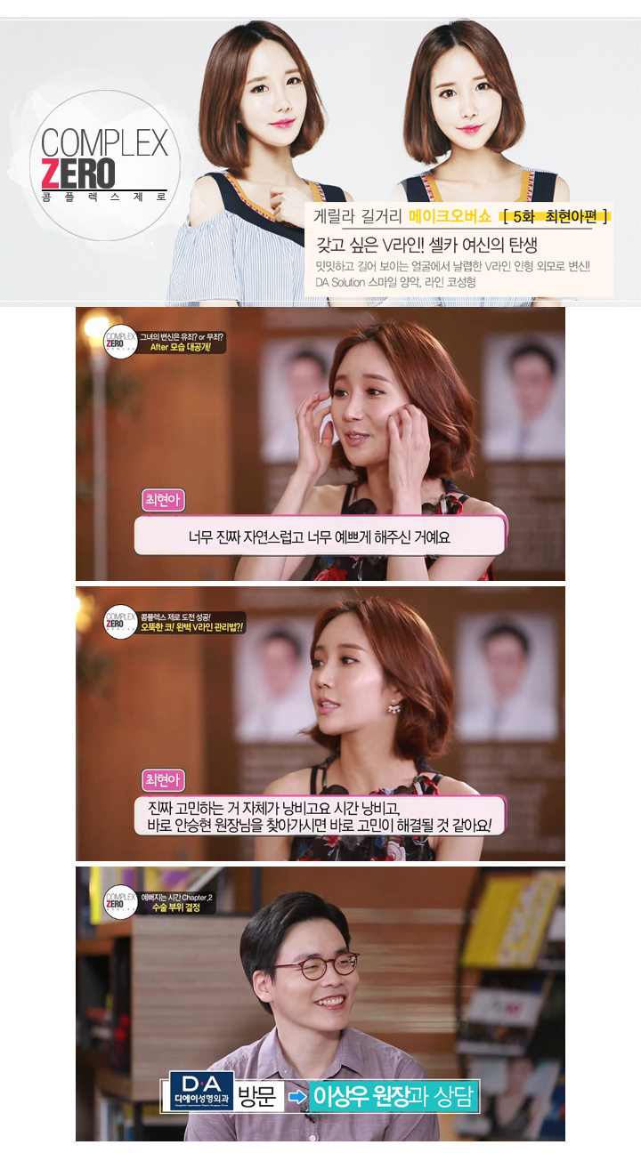 디에이성형외과 콤플렉스제로 5대 제로女 최현아편! 관련 이미지 8