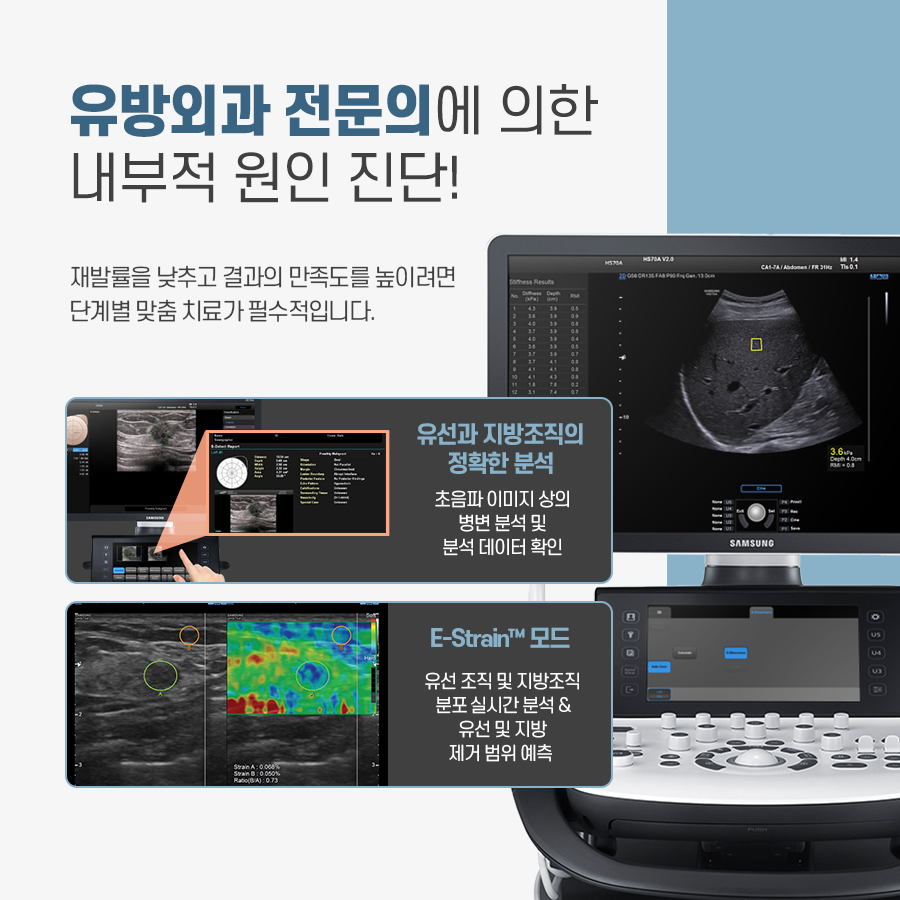 여유증, 치료와 가슴 탄력까지 잡으려면? 관련 이미지 6