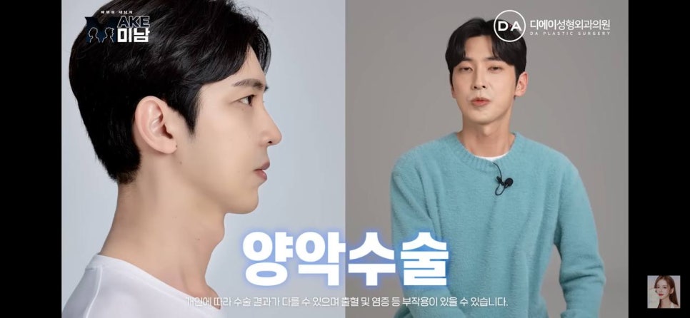 디에이성형외과 | 맥미남 시한폭탄내남자 개인인터뷰 근황 느낀점 관련 이미지 55