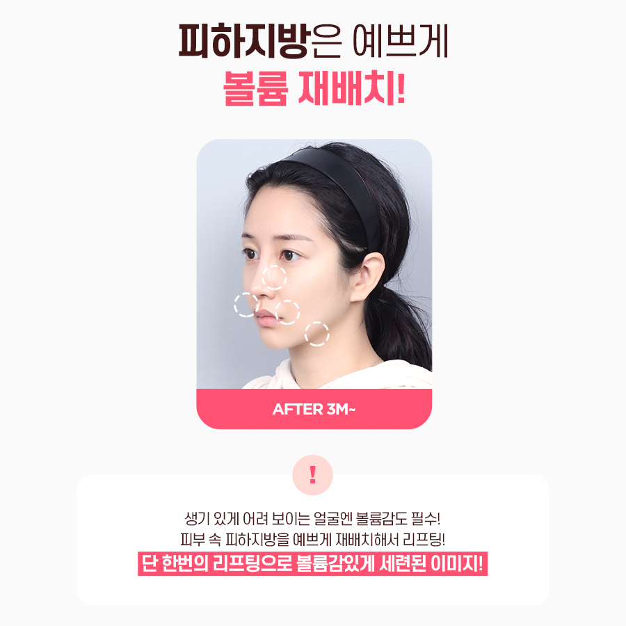 처진얼굴, 탄력개선에 효과적인 시술 방법 관련 이미지 9