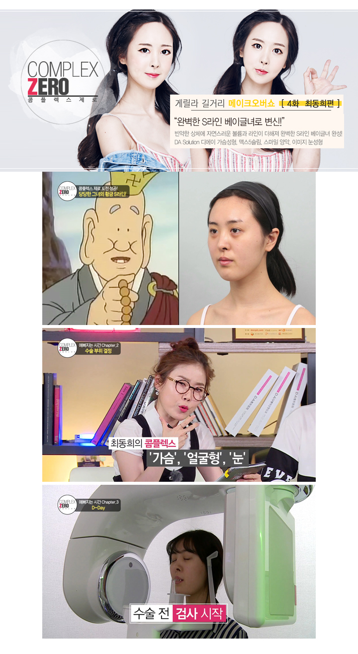 디에이성형외과 콤플렉스제로 S라인 베이글녀 최동희 관련 이미지 6