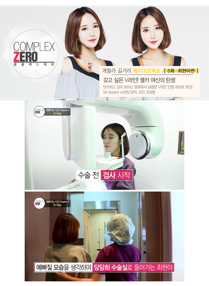 디에이성형외과 콤플렉스제로 5대 제로女 최현아편! 관련 이미지 7