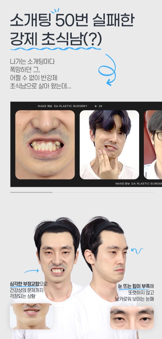 무엇이든물어보살 홍민기 수술전후 관련 이미지 2