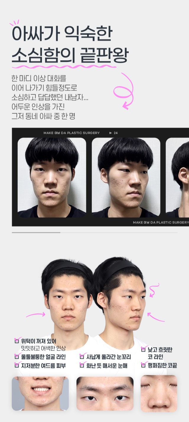 [디에이성형외과] 맥미남(MAKE미남) 소심이내남자 | 의벤져스 솔루션 관련 이미지 3