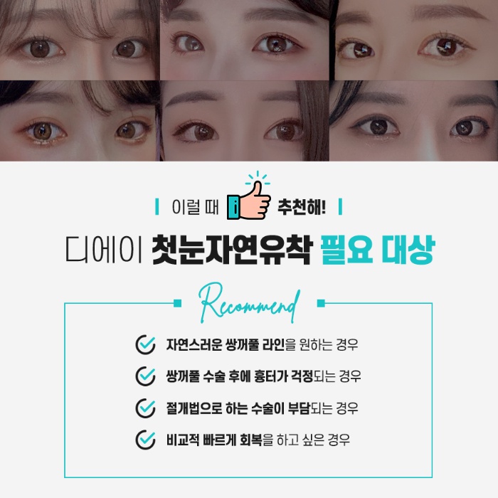 쌍꺼풀수술 후 풀림 현상을 예방하기 위해서는? 관련 이미지 9