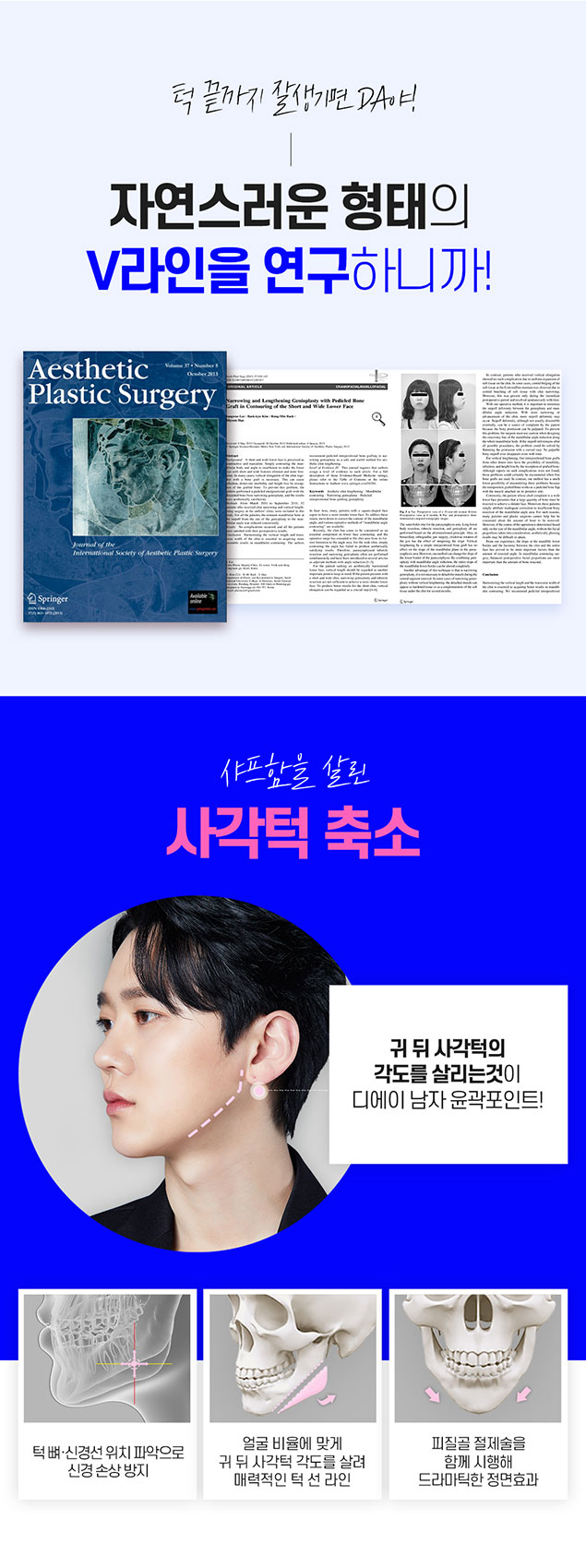 남자 윤곽 수술 알아볼 때 주의사항 관련 이미지 4