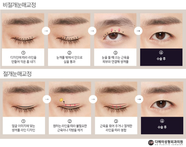 자연스러운 남자성형을 원한다면 관련 이미지 8