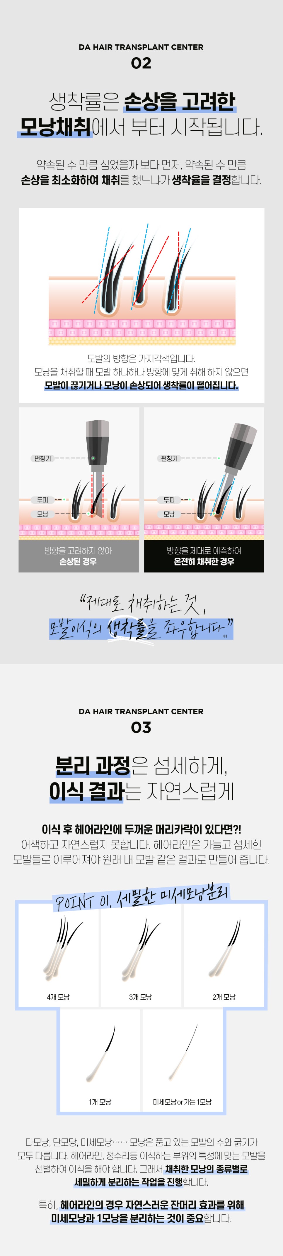 남자 헤어라인 모발이식 후기 비용 궁금하다면 관련 이미지 4