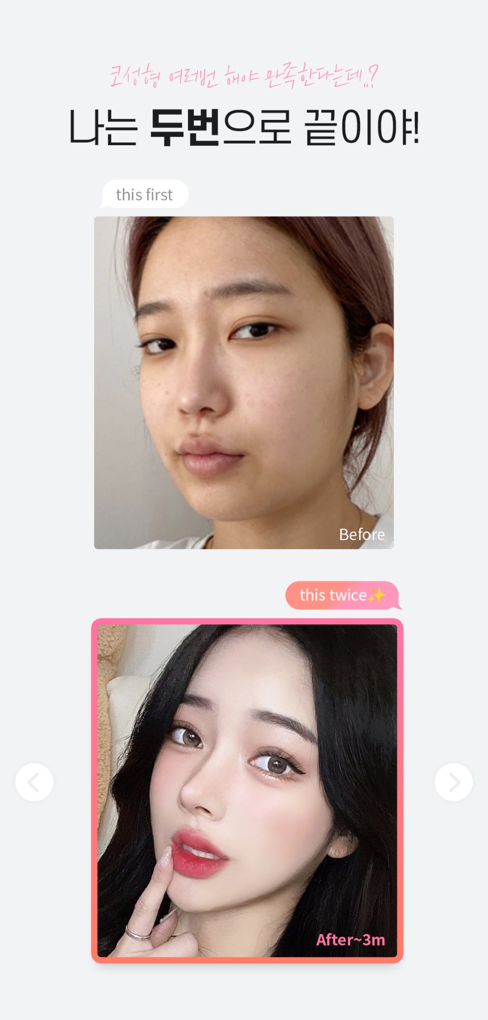 마지막 코재수술 원한다면♡ [DA성형외과] 관련 이미지 3