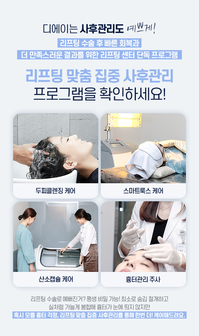 미니리프팅 후기 가격 통증 관련 이미지 6