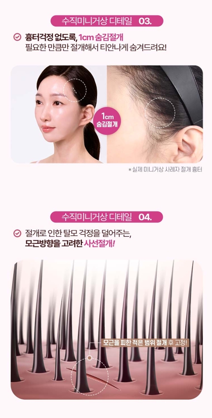 수직미니거상, 자연스러운 리프팅을 원한다면 알아볼 점 관련 이미지 6