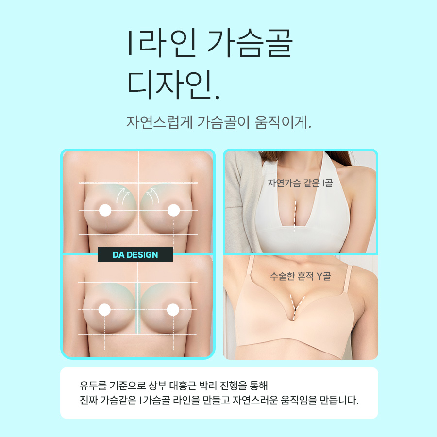 나에게 맞는 가슴성형, 체크 리스트 관련 이미지 3