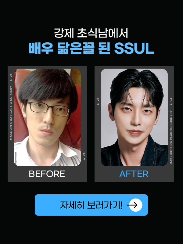 맥미남 무엇이든물어보살 성형남 홍민기 변천사 관련 이미지 7