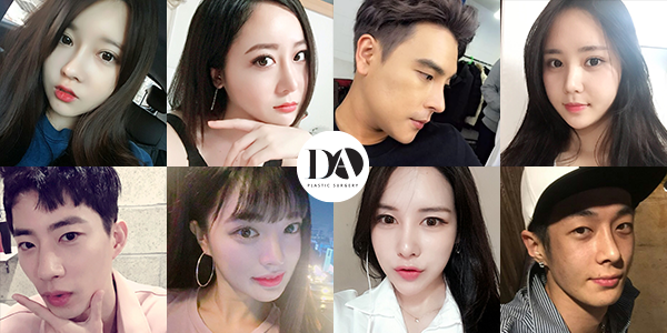 이상적인 코성형? A-Z 코유형별 방법을 알아보자 관련 이미지 22
