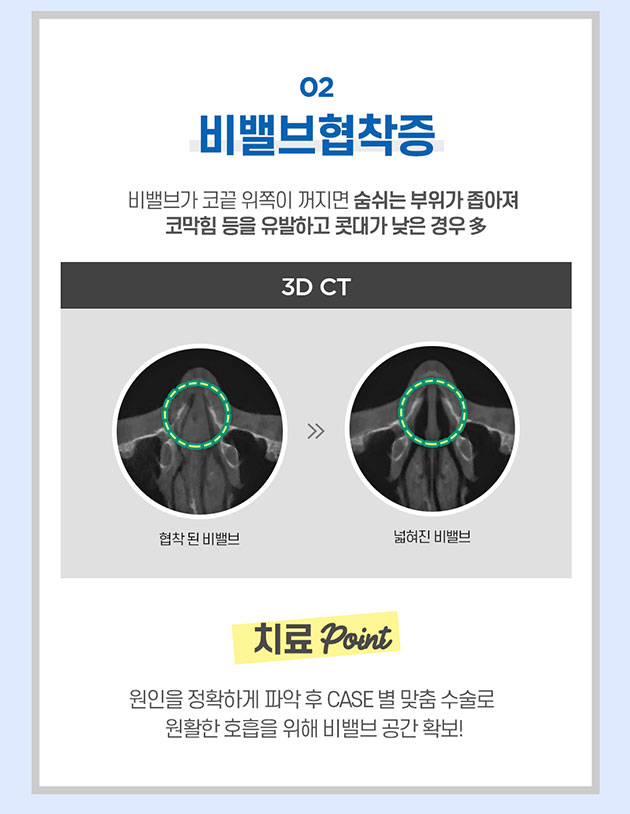 남자 기능코 수술 제대로 알고해야 관련 이미지 7
