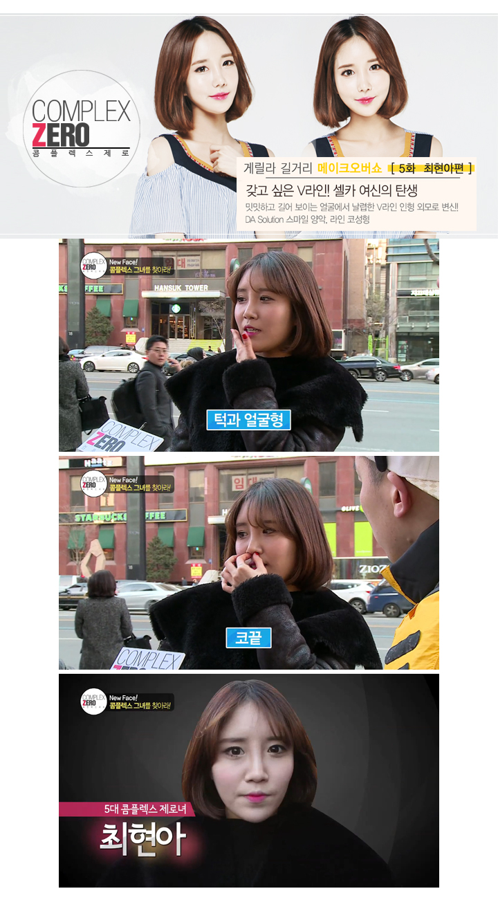 디에이성형외과 콤플렉스제로 5대 제로女 최현아편! 관련 이미지 3