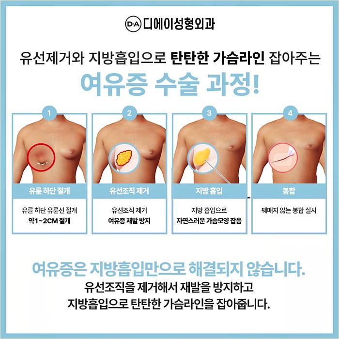 여성형유방증, 이런 경우 수술을 권장합니다. 관련 이미지 5