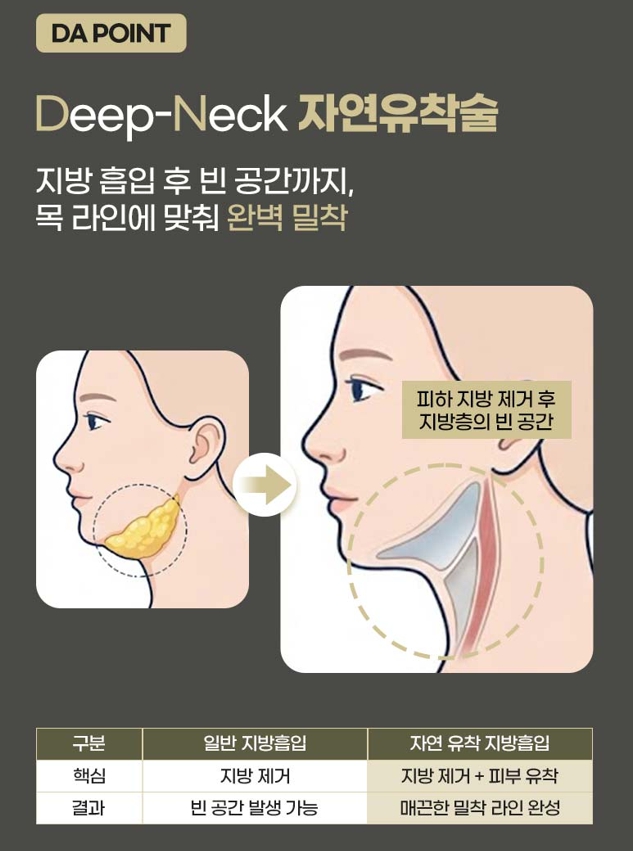 What Is Double-Chin Muscle Tightening? An Introduction to Improvement Methods by Cause image 8