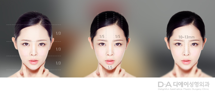유형별 코성형의 특징과 방법 관련 이미지 2