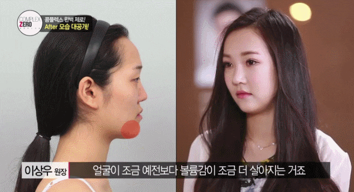 콤플렉스제로 7화 인형미모 한희수 관련 이미지 18
