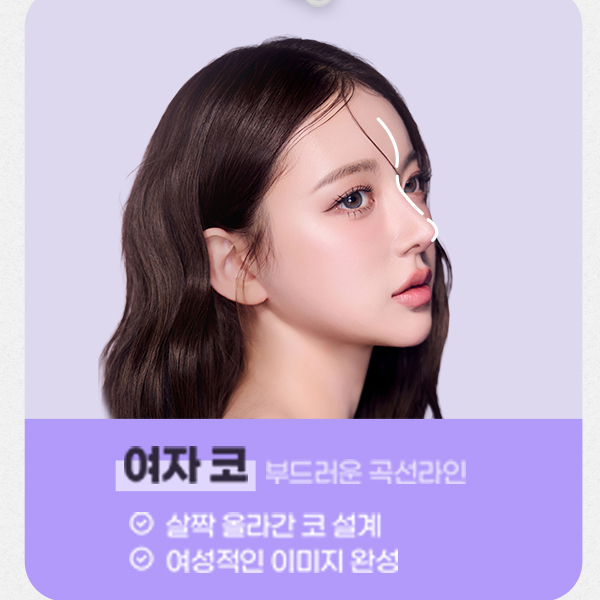 Type-Specific Male Rhinoplasty: A Natural, Refined Impression That Feels Like Your Own Nose image 4