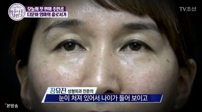 아름다운당신3 지나라씨와의 숨겨진 뒷이야기 공개 with 디에이성형외과 관련 이미지 5