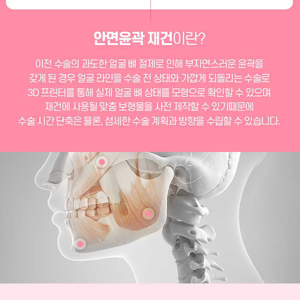 Not Satisfied After Your First Surgery? A Guide to Revision Facial Contouring Surgery image 9