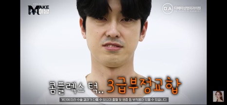 디에이성형외과 | 맥미남 시한폭탄내남자 개인인터뷰 근황 느낀점 관련 이미지 5