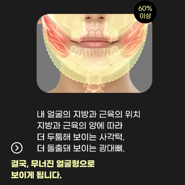 얼굴형 고민 끝! 연조직윤곽술로 균형 잡힌 인상 만들기 관련 이미지 4