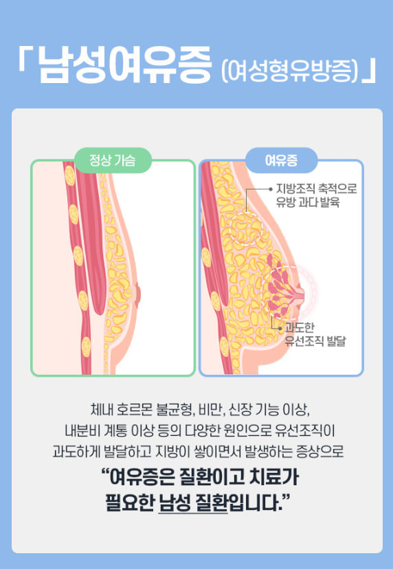 여유증치료, 망설이고 있다면? 관련 이미지 5