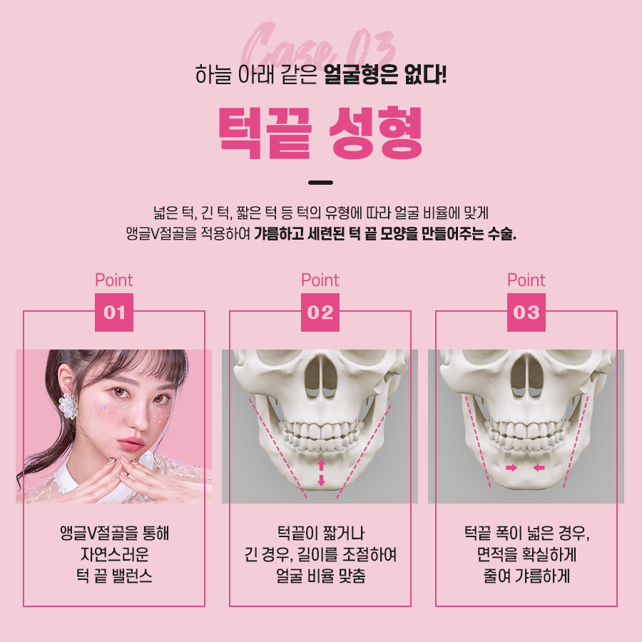 안면윤곽 수술 전 확인해야 하는 것은? 관련 이미지 8