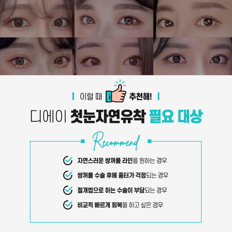 쌍꺼풀수술 후 풀림 현상을 예방하기 위해서는? 관련 이미지 9