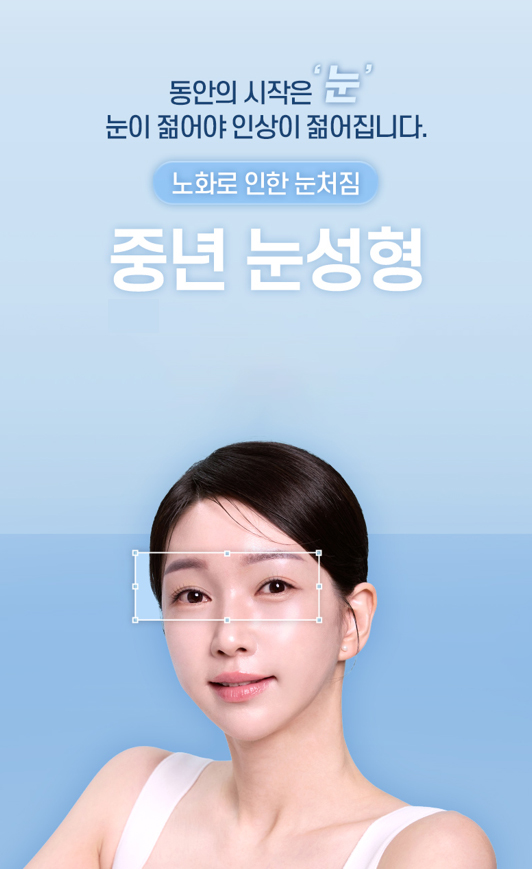 중년 눈성형, 처진 눈꺼풀의 원인에 따라 수술법이 달라집니다 관련 이미지 1