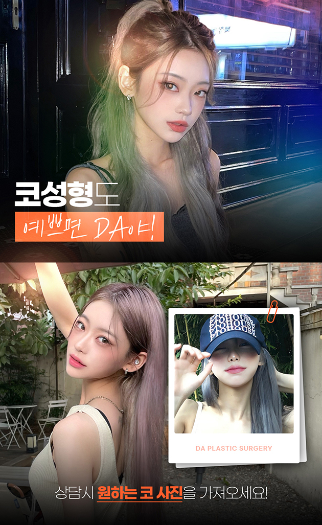 오래도록 오똑하게 자가늑코성형 관련 이미지 7