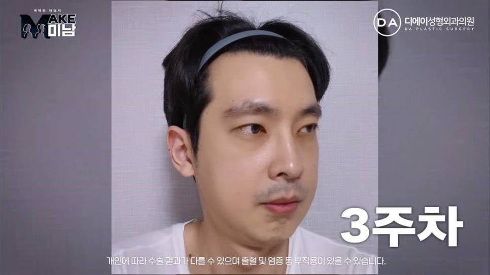 무엇이든물어보살 홍민기 성형 맥미남 후기 관련 이미지 8