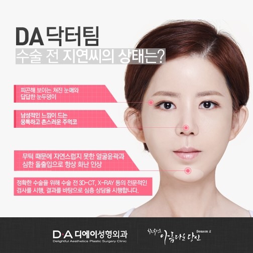 아름다운당신 이지연편, 삼악수술이란? 관련 이미지 3