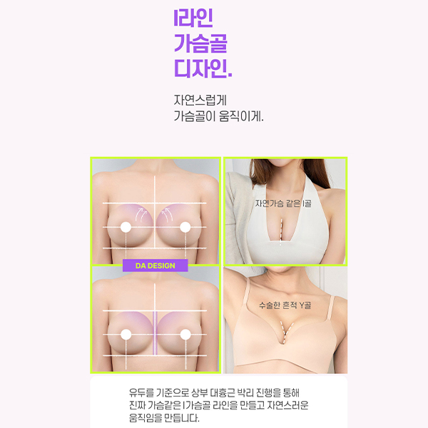 A Complete Guide to Lift Breast Surgery for Improving Breast Sagging image 6
