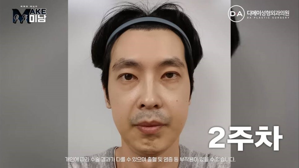 무엇이든물어보살 홍민기 성형 맥미남 후기 관련 이미지 7