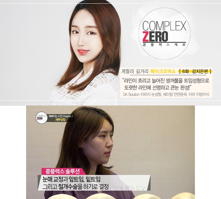 콤플렉스제로 트임성형 끝판왕 강지은 관련 이미지 6