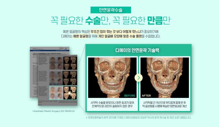 디에이성형외과, 윤곽3종으로 예쁨 UP 관련 이미지 6