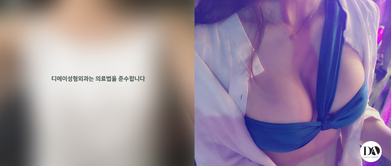 성공적인 휴가를 위한, 디에이 가슴성형 관련 이미지 7