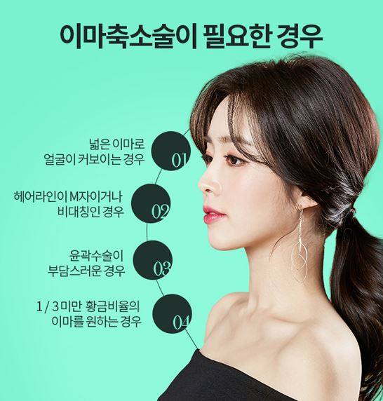 디에이성형외과 이마축소술, 작아보이는 얼굴 효과! 관련 이미지 7