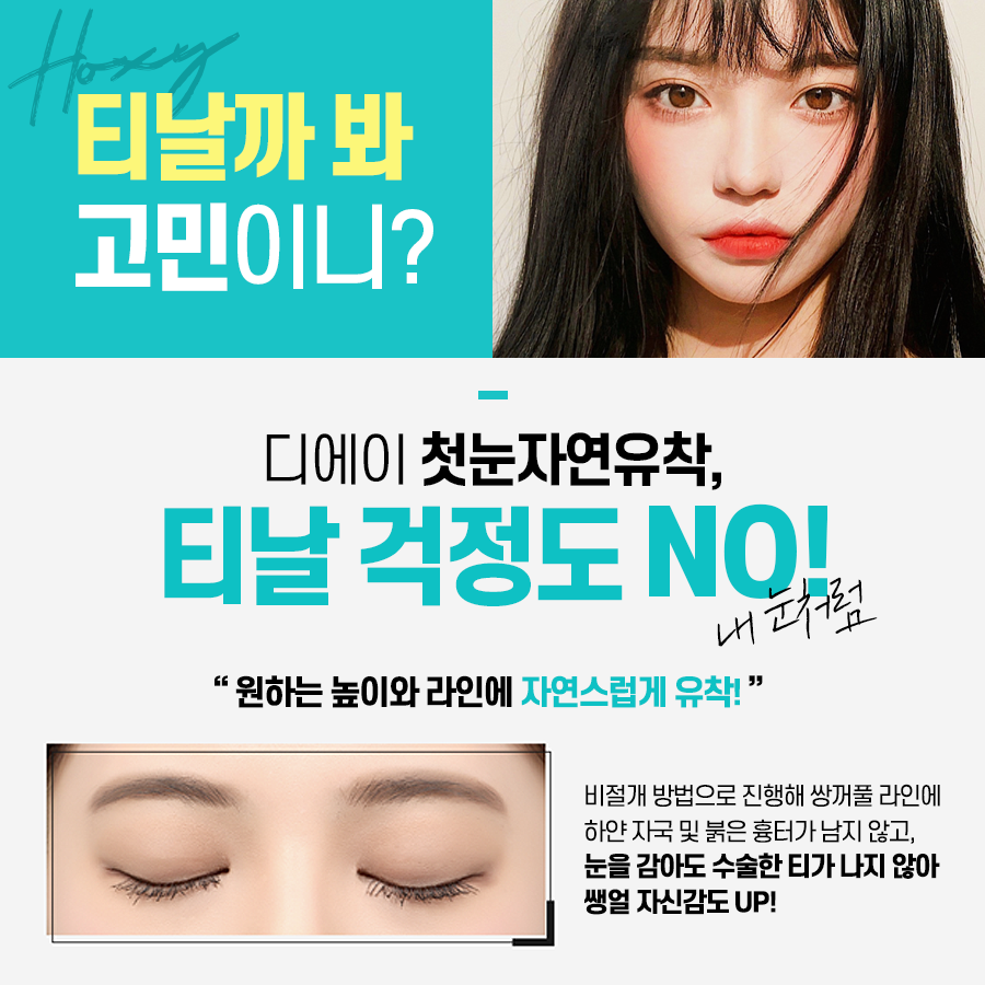 이미지에 맞게 라인 조절이 가능한 눈성형은? 관련 이미지 9