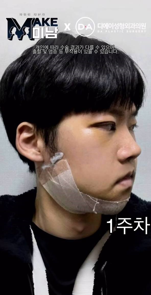 [맥미남] 소심이내남자 한 눈에 보는 외모변천사 관련 이미지 4