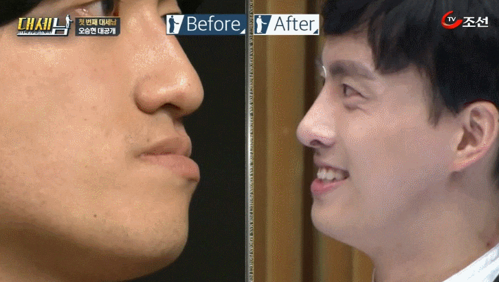대세남 프랑켄슈타인 안면비대칭 오승현 관련 이미지 15